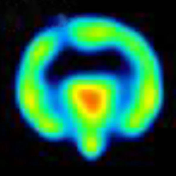 Published PET map of a minipig brain, coronal slice: [11C]yohimbine binding, highest in the centre of the brain.