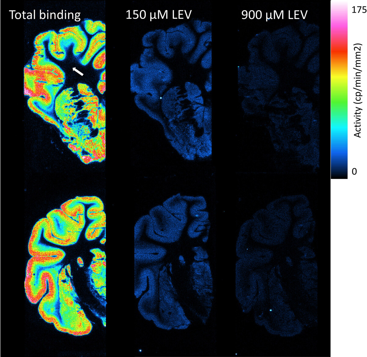 Six rainbow-coloured BeaQuant autoradiograms of coronal minipig brain hemisections in two rows, at the level of the striatum (top) and the start of the dorsal hippocampus (bottom). Left column, total [3H]UCB-J binding: bright in the folded grey matter and dark in white matter, marked by a white arrow. Middle and right columns, neighbouring sections with 150 and 900 micromolar levetiracetam: uniformly dark blue. Colour bar: activity from 0 to 175 counts per minute per square millimetre.